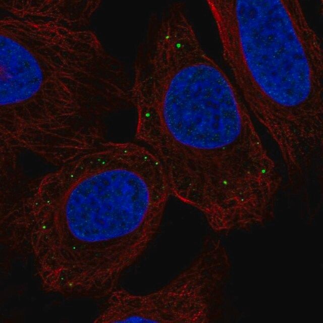Anti-TMEM215 antibody produced in rabbit