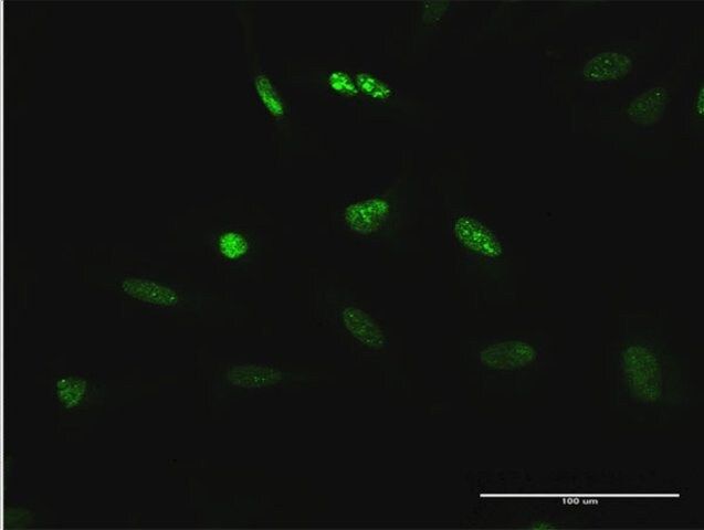 Anti-TCEB3 antibody produced in rabbit