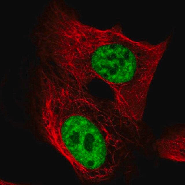 Anti-TCERG1 antibody produced in rabbit