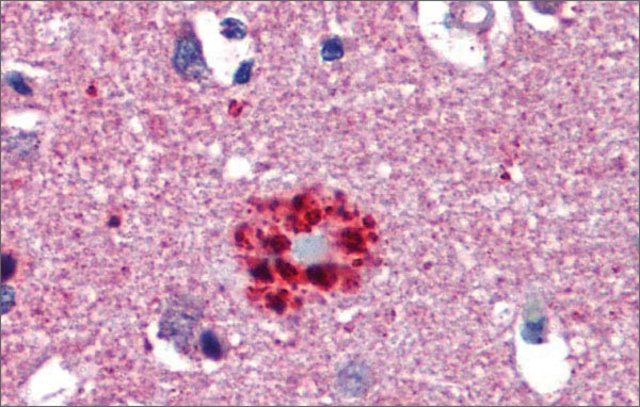 Anti-TCF21 antibody produced in rabbit