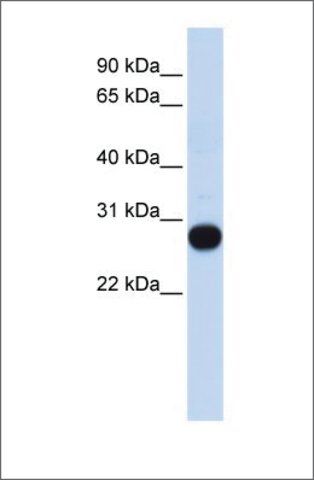 Anti-TCEAL4 antibody produced in rabbit