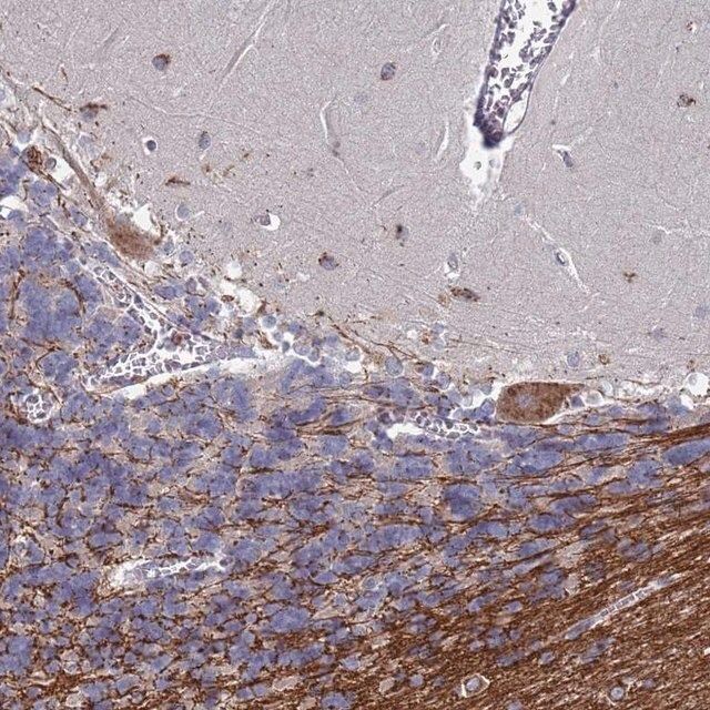 Anti-TCEANC2 antibody produced in rabbit