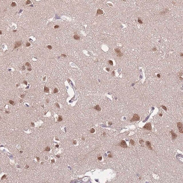 Anti-TFAP2D antibody produced in rabbit
