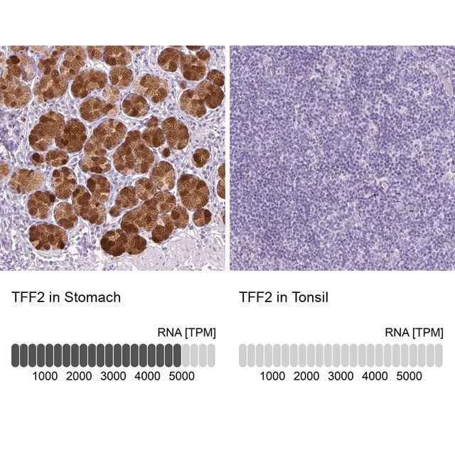 Anti-TFF2 antibody produced in rabbit