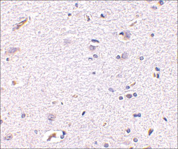 Anti-Syntaphilin (ab1) antibody produced in rabbit