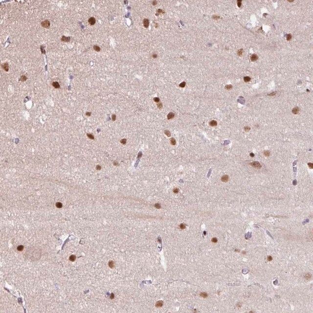 Anti-TAF1A antibody produced in rabbit
