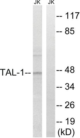 Anti-TAL-1 antibody produced in rabbit