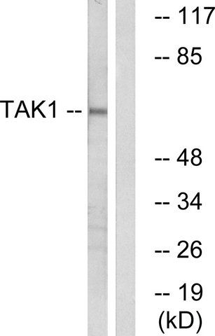 Anti-TAK1 antibody produced in rabbit