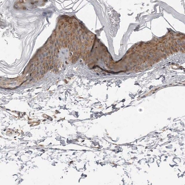 Anti-SRGAP2 antibody produced in rabbit