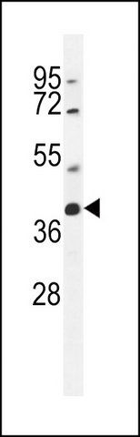 ANTI-SRD5A2L2 (C-TERM) antibody produced in rabbit