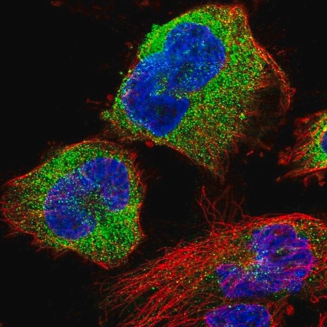 Anti-STK38L antibody produced in rabbit