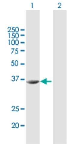 Anti-STRADA antibody produced in mouse