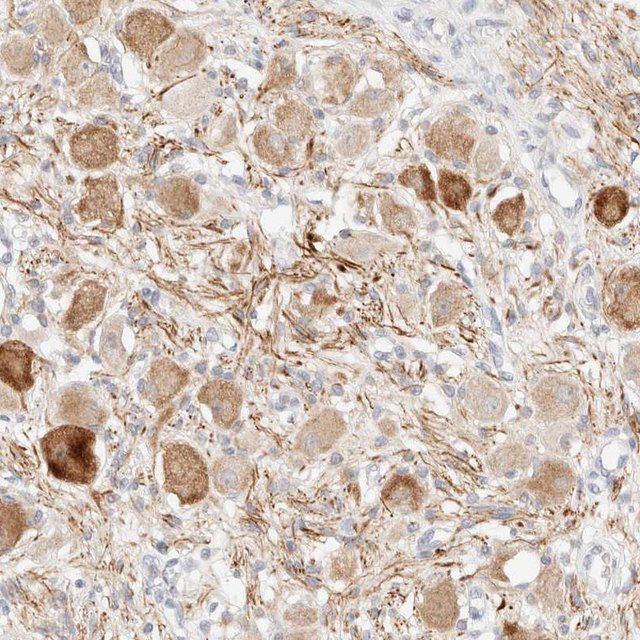 Anti-SNTB1 antibody produced in rabbit