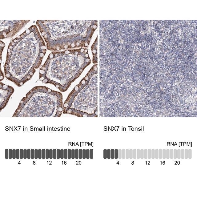 Anti-SNX7 antibody produced in rabbit