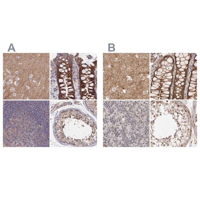 Anti-SORBS1 antibody produced in rabbit