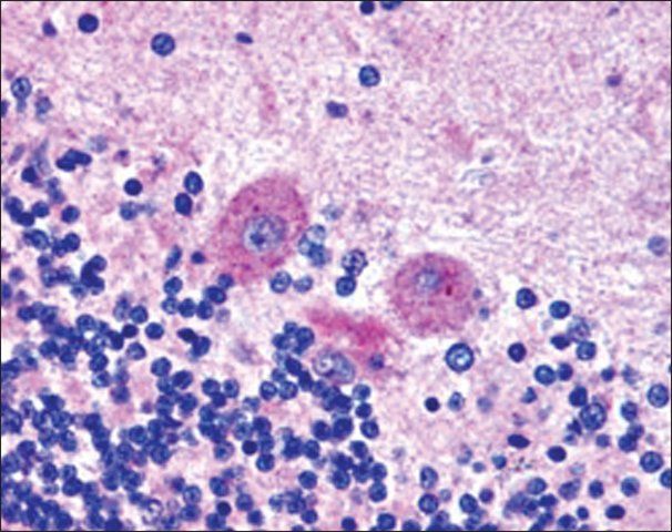 Anti-SNX26/TCGAP, C-Terminal antibody produced in goat