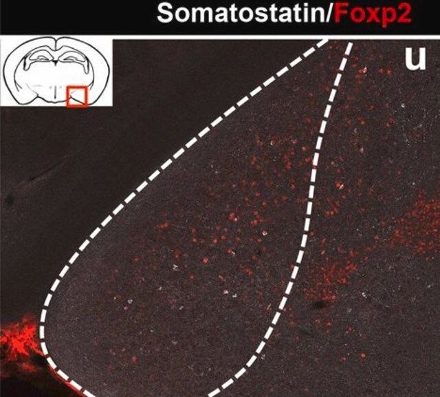 Anti-Somatostatin Antibody, clone YC7