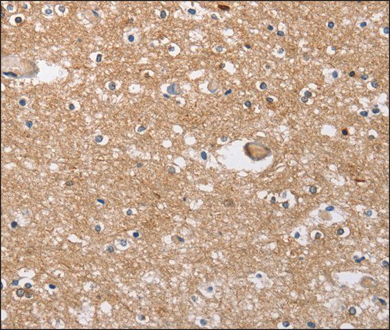 Anti-SOCS2 antibody produced in rabbit