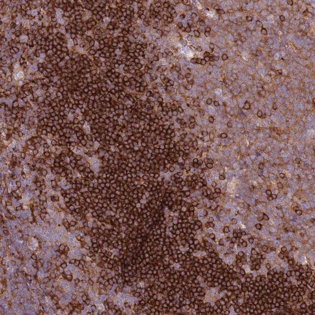 Anti-SNX21 antibody produced in rabbit