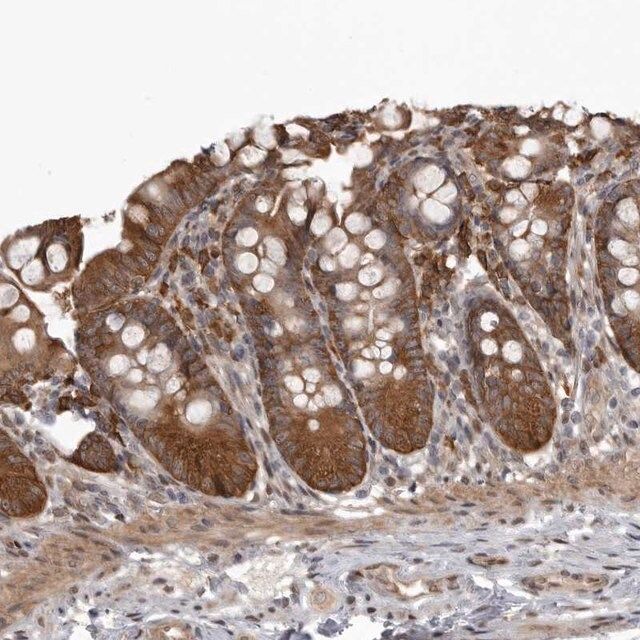 Anti-SNX16 antibody produced in rabbit