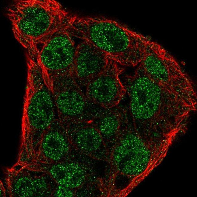 Anti-SOCS1 antibody produced in rabbit