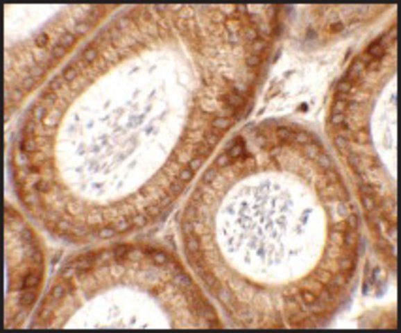 Anti-SPATA6 antibody produced in rabbit