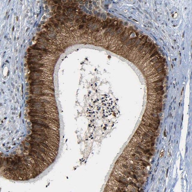 Anti-SPCS2 antibody produced in rabbit