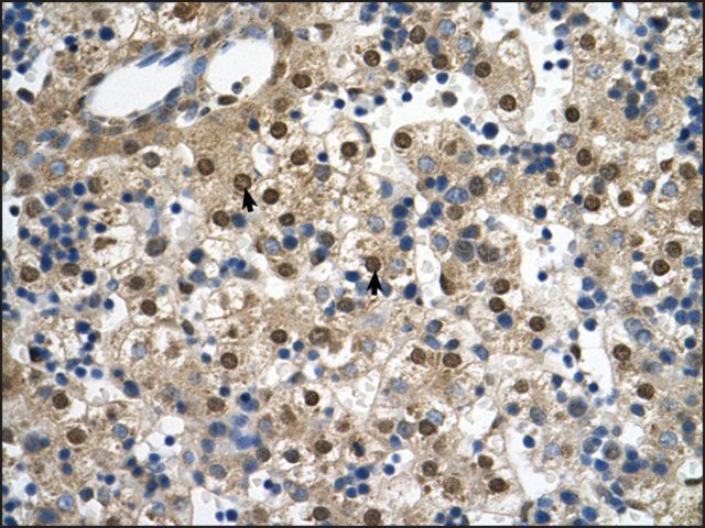 Anti-SQLE antibody produced in rabbit