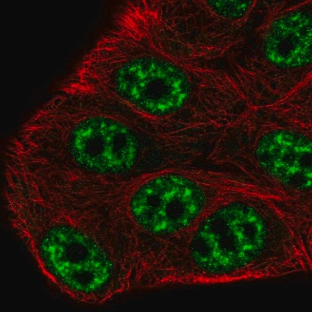 Anti-SPTSSB antibody produced in rabbit