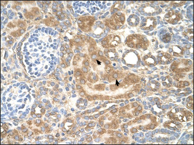 Anti-SPTLC1 antibody produced in rabbit