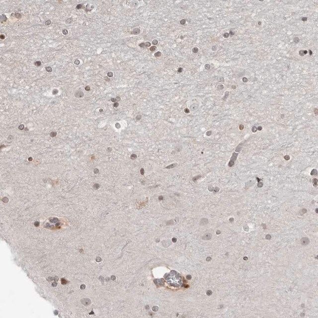 Anti-SRGAP2 antibody produced in rabbit
