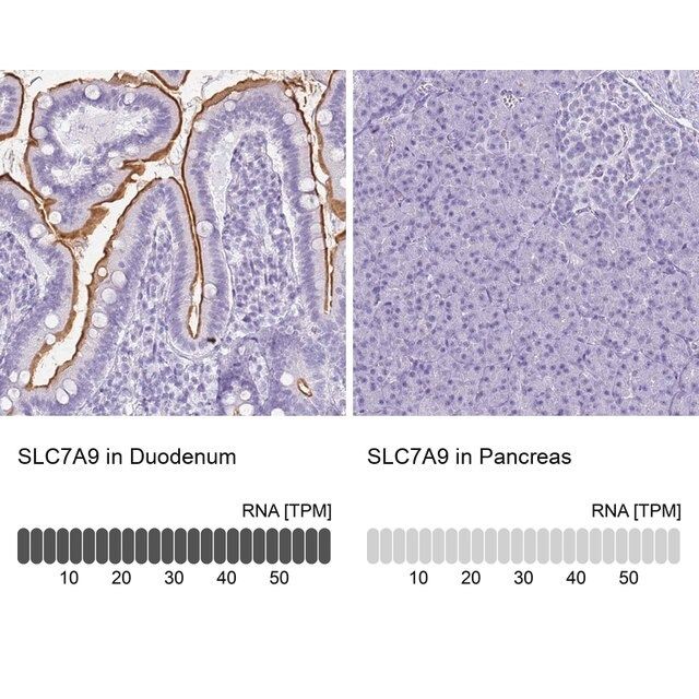 Anti-SLC7A9 antibody produced in rabbit
