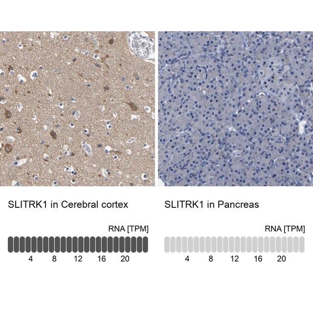 Anti-SLITRK1 antibody produced in rabbit