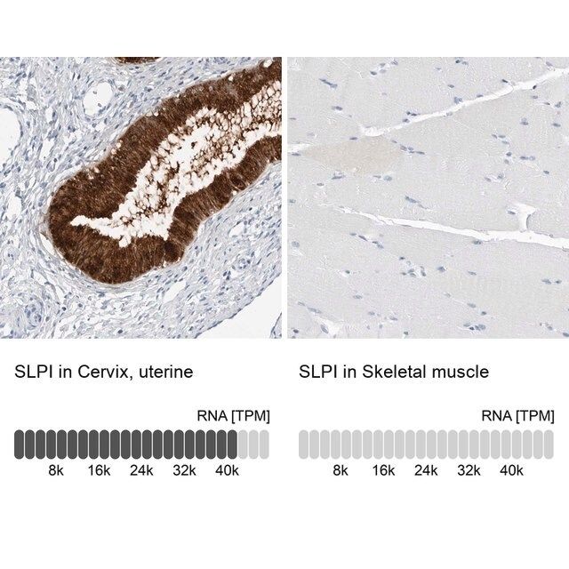 Anti-SLPI antibody produced in rabbit