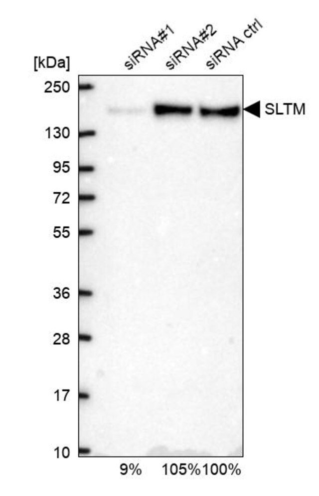Anti-SLTM antibody produced in rabbit