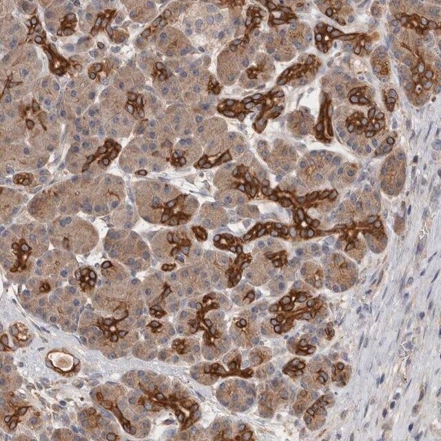 Anti-SMAP2 antibody produced in rabbit