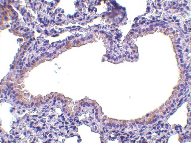 Anti-SLPI (ab2) antibody produced in rabbit
