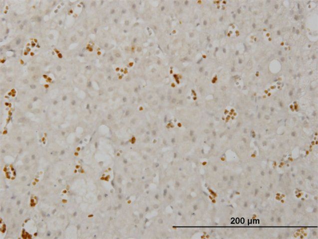 ANTI-SMG1 antibody produced in mouse