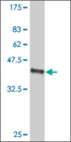 ANTI-SMO antibody produced in mouse