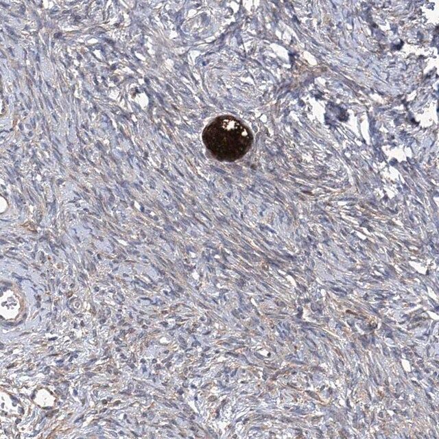Anti-SMS antibody produced in rabbit