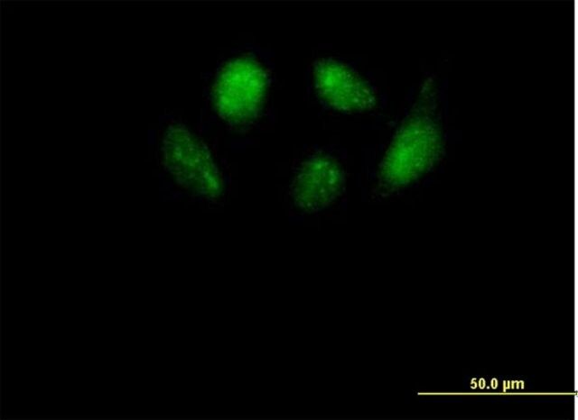Anti-SMU1 antibody produced in mouse