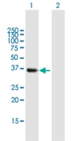 Anti-SMN2 antibody produced in mouse