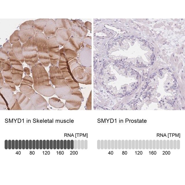 Anti-SMYD1 antibody produced in rabbit