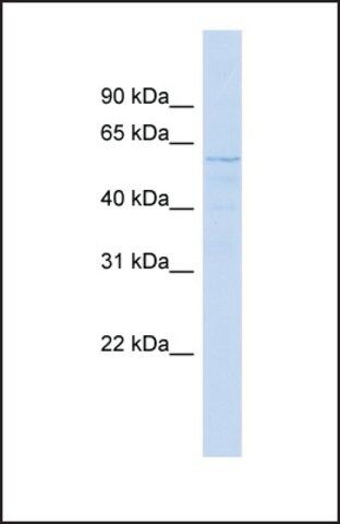 Anti-SMYD1 antibody produced in rabbit