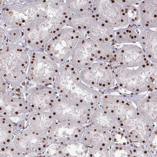Anti-SNAI1 antibody produced in rabbit