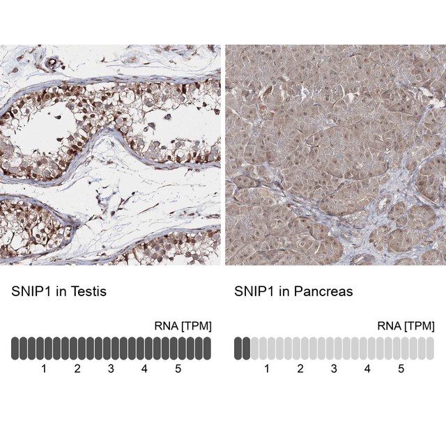 Anti-SNIP1 antibody produced in rabbit