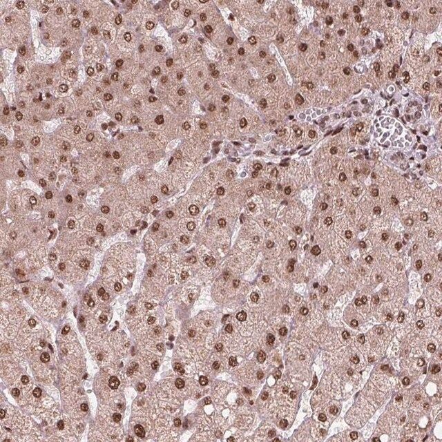 Anti-SNRNP35 antibody produced in rabbit