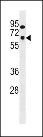 ANTI-SNRNP70 (CENTER) antibody produced in rabbit