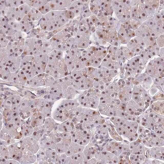 Anti-SNRPA1 antibody produced in rabbit