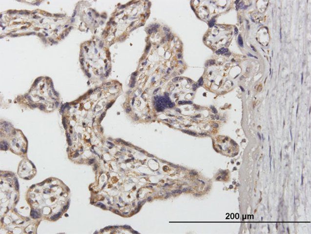 Anti-SNX1 antibody produced in mouse